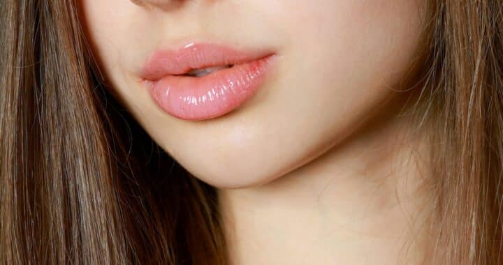 Injection pour les lèvres : faut-il les faire en cabinet dentaire ?